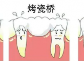 牙齿缺失修复方法，缺了一颗牙怎么办