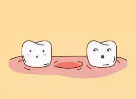 缺一颗牙齿怎么补最好，牙齿缺失有什么影响