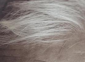 毛发变白的原因引起的，如何控制白发增多