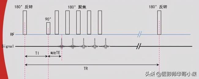 tir的意思