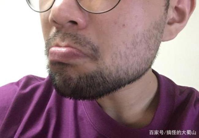 为什么要远离留胡子的男生