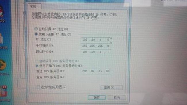 ip地址怎么设置默认网关