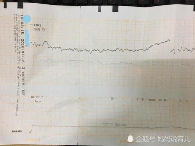 从孕几周开始做胎心监护