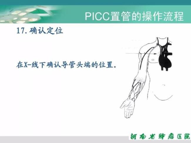 picc维护标准化流程