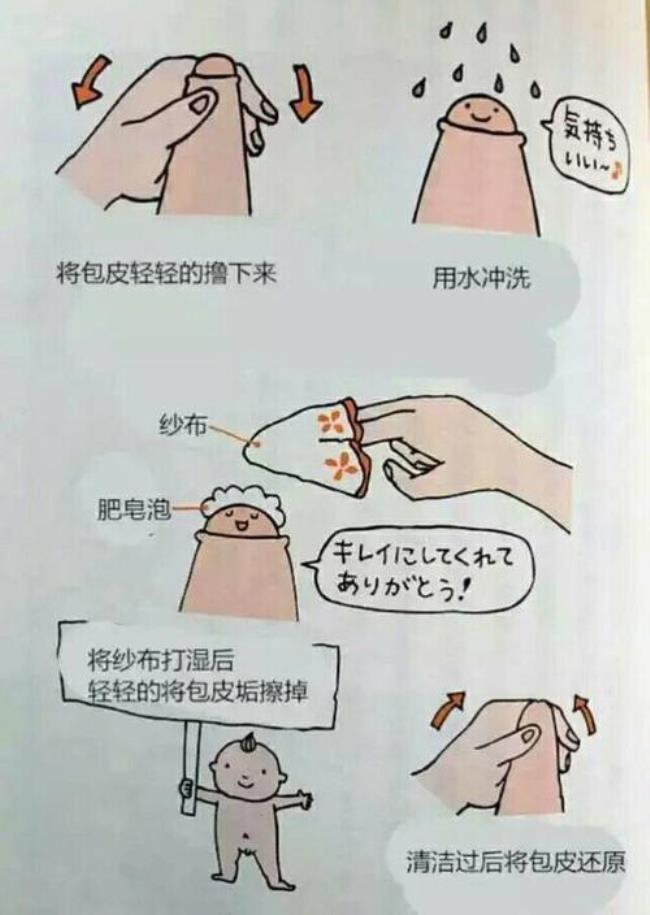 包皮过长一定需要手术吗