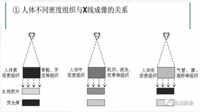 x光片成像原理