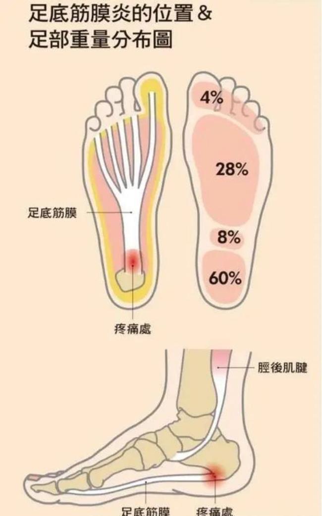 后足跟痛是怎么回事