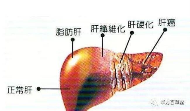 肝上面长了个东西是什么