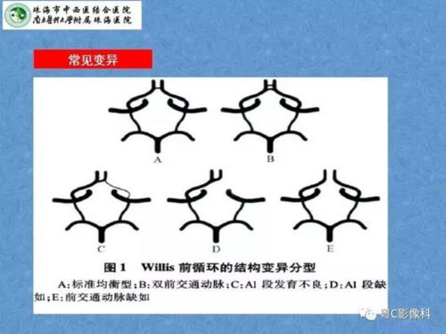 willis环的由来