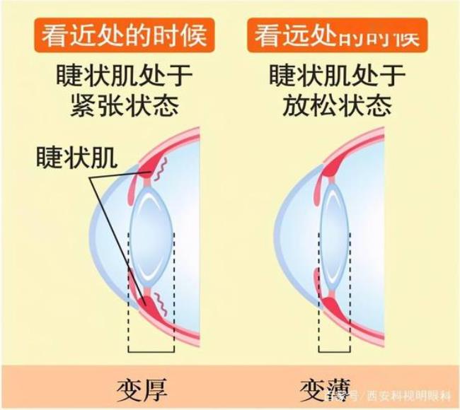 一个眼球有多少个睫状体