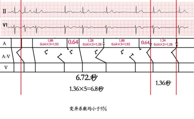 心电图专业报考条件