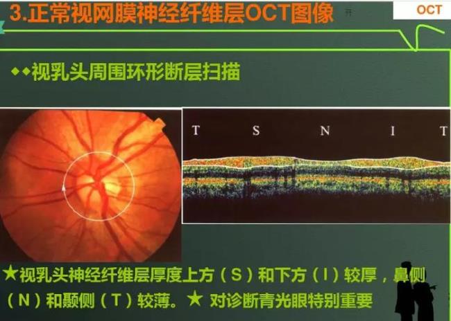 oct在组织化学上是什么意思