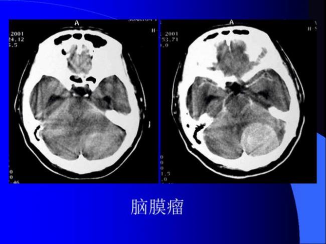 ct图像排版的原则