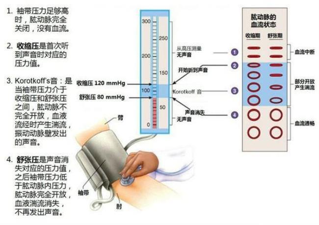 血压计千帕标准是多少