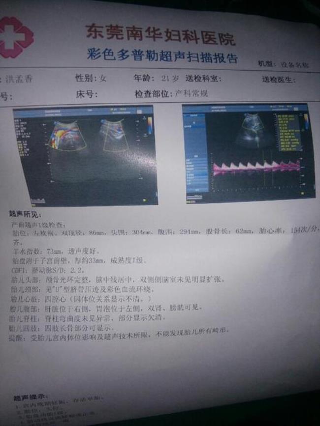 胎心154次正常吗