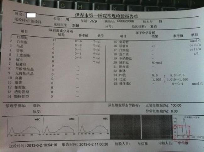 怎样看尿液化验单