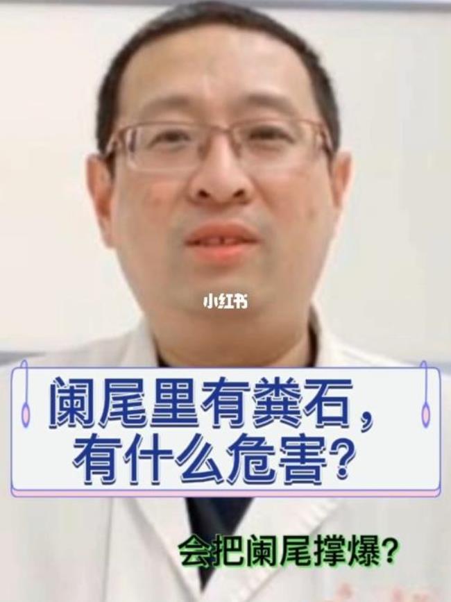 阑尾炎一定会有压痛和反跳痛吗