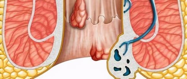 肛门口痛怎么回事