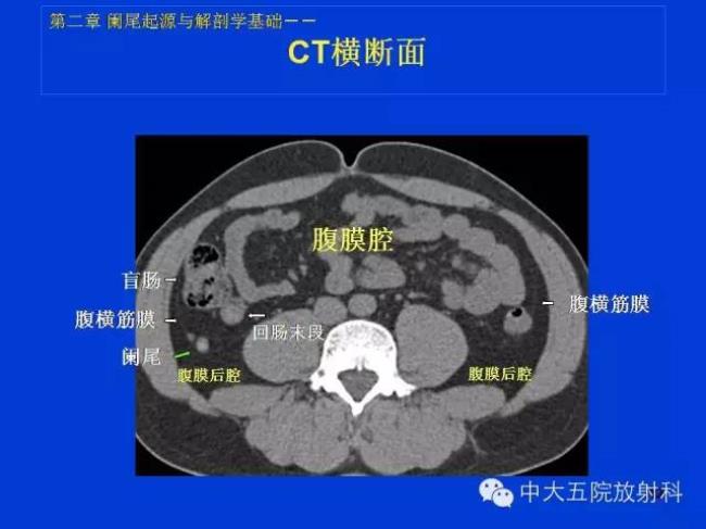 增强ct和普通ct区别