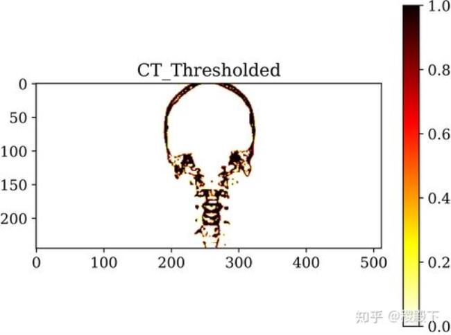 FBC和BMl医学是什么意思