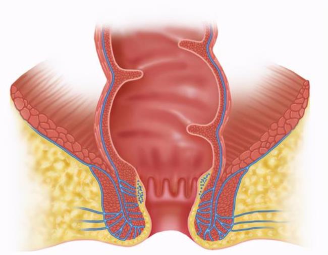 肛门疼痛怎么回事