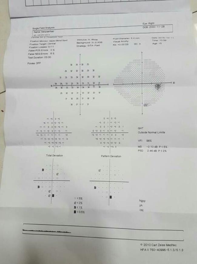 一只眼睛的视野范围