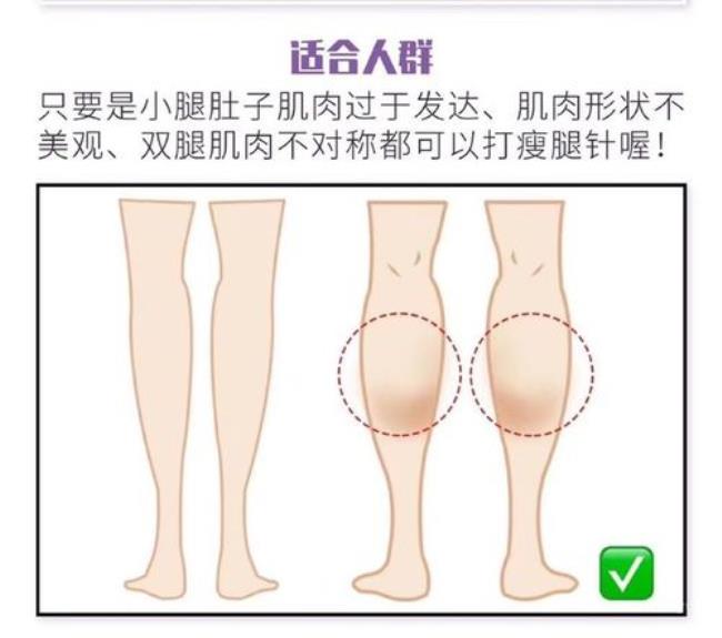 大腿和小腿很粗怎么减肥