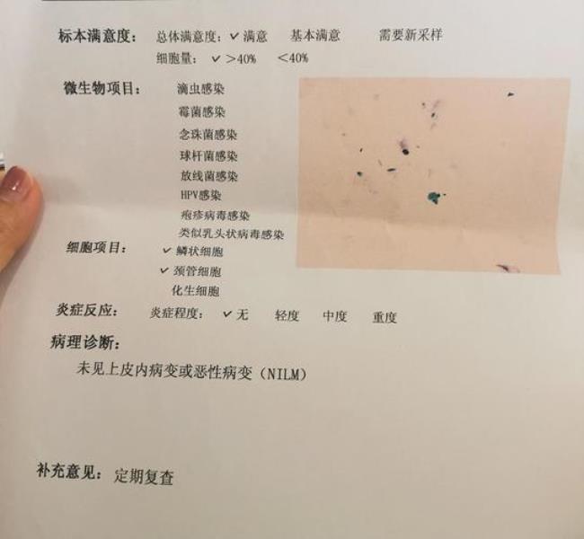 tct是检查什么的