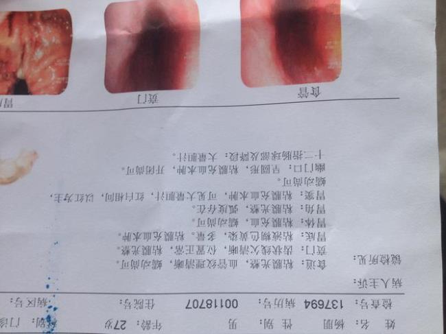 做胃镜检查多少钱