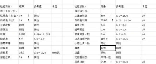 怎样看尿常规检查结果