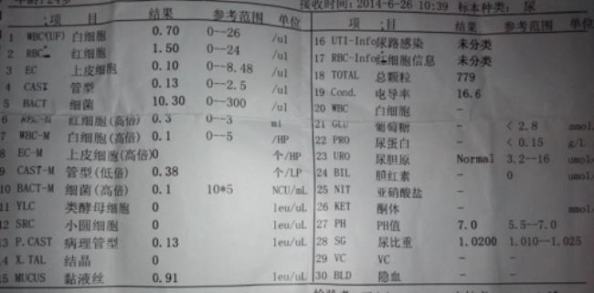 尿检可以检查出什么