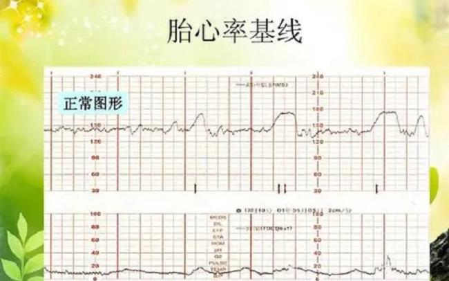 孕12周胎心率180正常吗