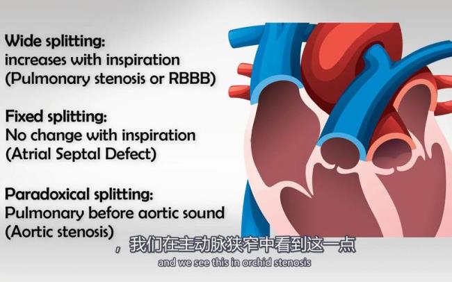 第二心音的组成主要是