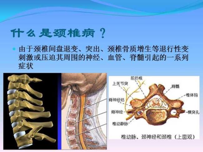 治疗颈椎的最好的方法