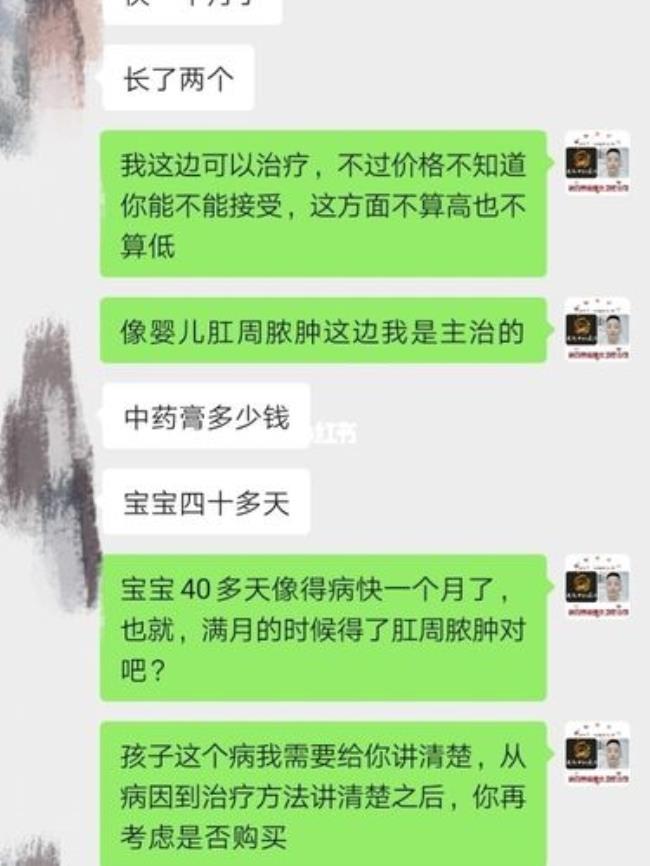 肛周囊肿怎么治疗