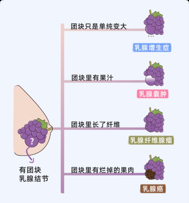 乳腺结节能治愈吗