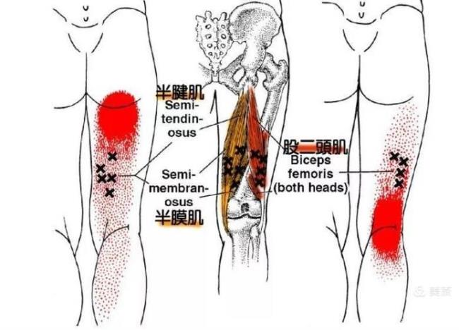 为什么大腿内侧痛