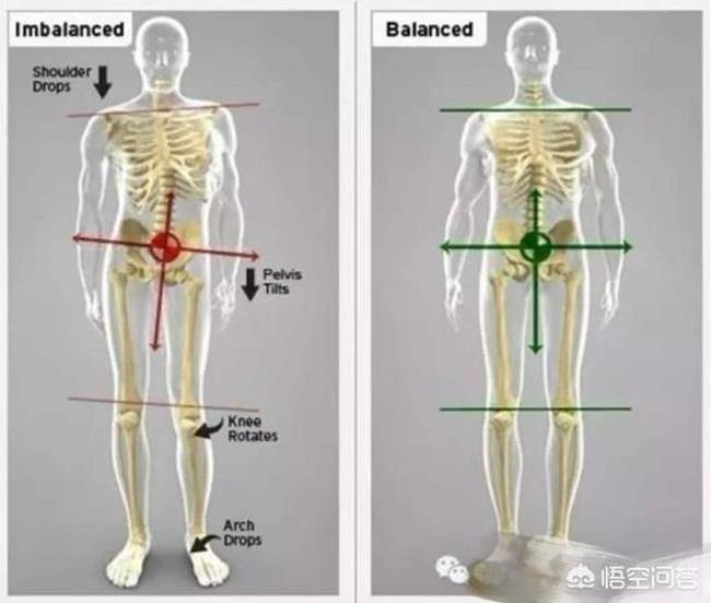 骨盆倾斜长短腿矫正的方法