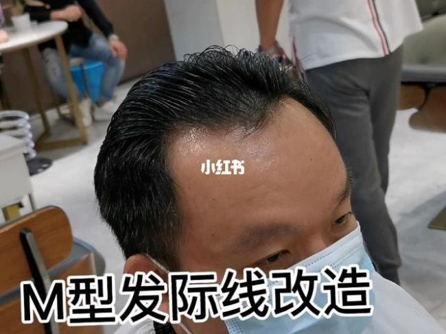 m型发际线卷发怎么剪