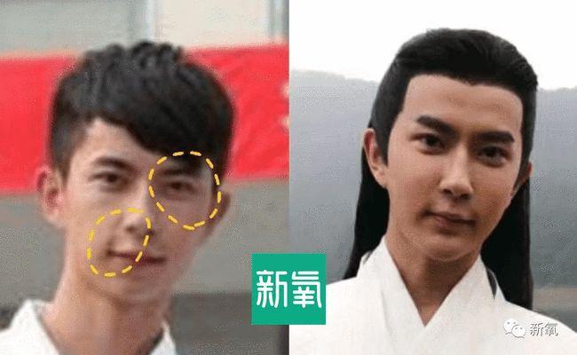 男生法令纹怎么消除