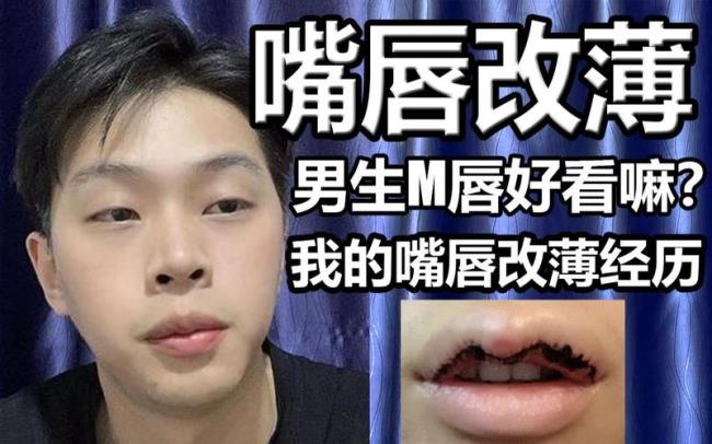 上嘴唇m型男人好看吗