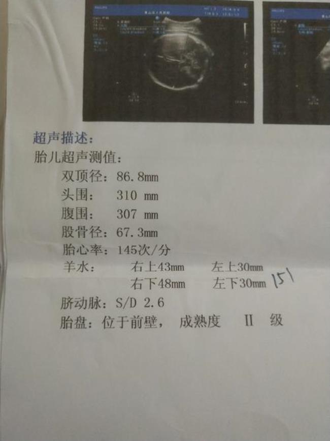 36周宝宝头围标准参考表