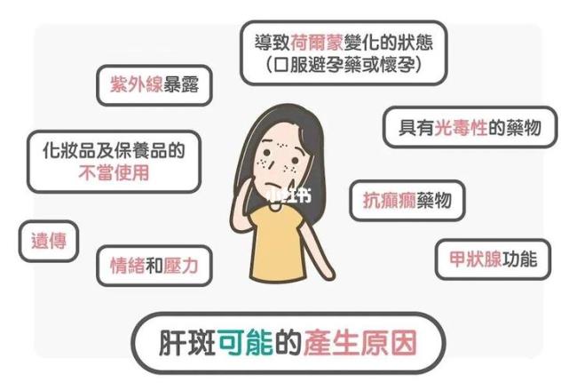 黄褐斑是怎么才形成的