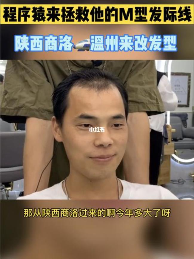 男生m型发际线怎么补救